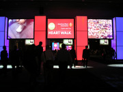 慢性心不全患者に対する運動療法：予後への効果は改善傾向に留まるものの安全性は証明